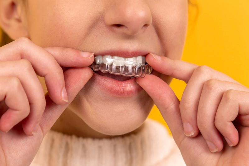 Single Implant result at Brighton Dental Clinic