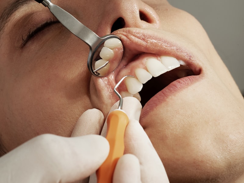 Teen Invisalign result at Brighton Dental Clinic